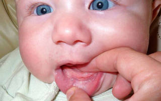 Крем для прорезывания зубов у младенцев