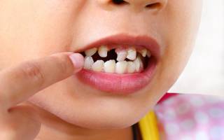 Как очистить налет на зубах у ребенка