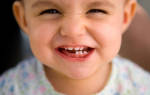 Смена зубов у детей схема