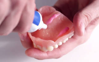 Крем для фиксации зубных протезов – какой лучше выбрать