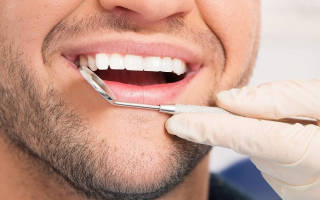 Протезирование передних верхних зубов – отзывы