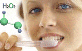 Отбеливание зубов перекисью водорода — белая магия