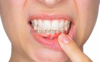 Таблетки антисептические для полости рта