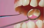 Перфорация корня зуба симптомы