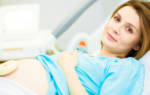 Можно ли делать анестезию при беременности