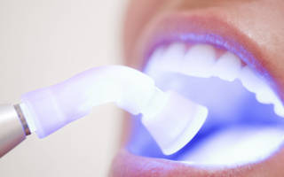 После чистки зубов ультразвуком нельзя