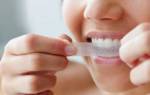 Отбеливание зубов полоски – какие лучше выбрать