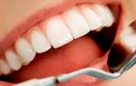 Отбелить зубы перекисью – преимущества и недостатки