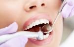Можно ли лечить зубы при гв