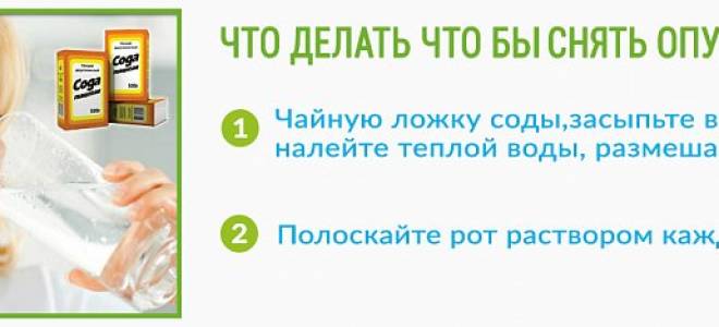 Опухла щека и болит
