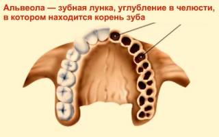 Альвеолит после удаления зуба — симптомы и лечение