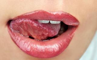 Лейкоплакия слизистой рта