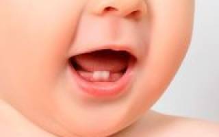 Порядок прорезывания зубов у младенцев