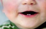 Температура при прорезывании коренных зубов у детей