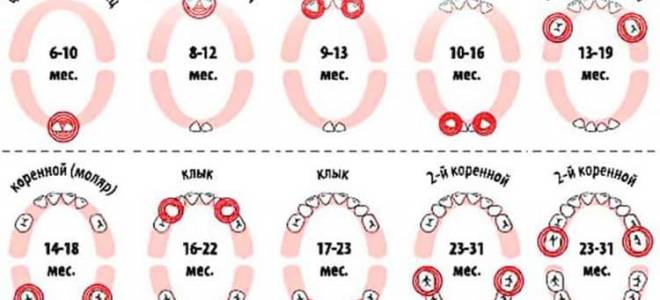 Как понять что у ребенка режутся зубки